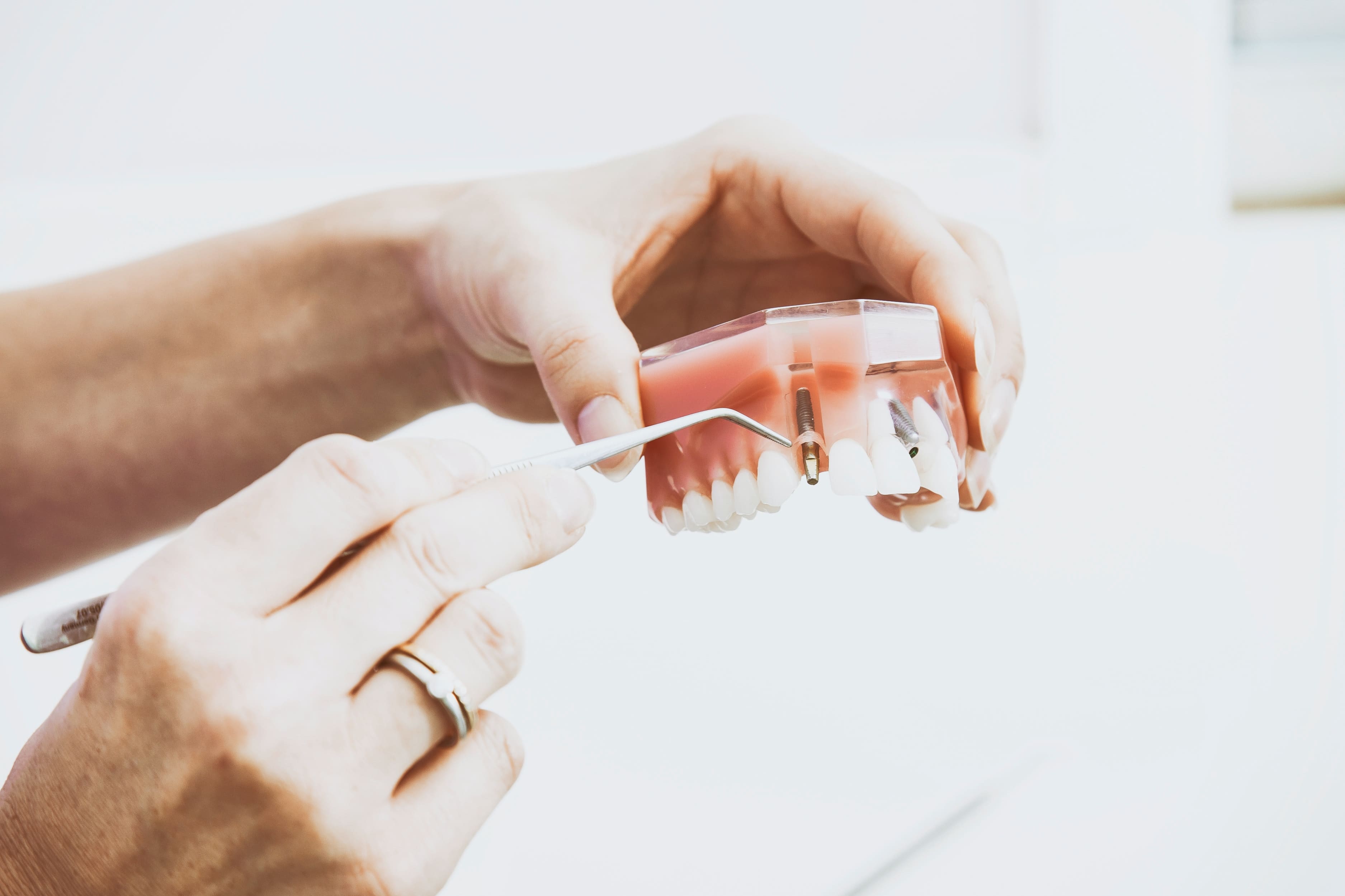 Dental Implants in CT